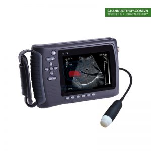 Máy khám thai có màn hình 5.0 TFT – LCD, pin > 4h