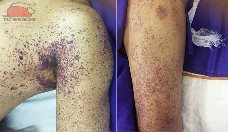 Cách nhận biết thịt lợn bị dịch tả Châu Phi và những nguy cơ khi ăn 10 Cách nhận biết thịt lợn bị dịch tả Châu Phi và những nguy cơ khi ăn